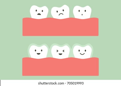 tooth cartoon vector flat style for design - before and after teeth wear silicone trainer or invisible braces, dental health concept