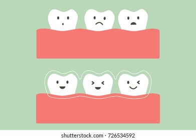 Tooth Cartoon Vector Flat Style For Design - Before And After Teeth Wear Silicone Trainer Or Invisible Braces, Dental Care Concept