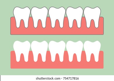 tooth cartoon vector flat style for design, healthy teeth on gum for dental care