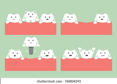 tooth cartoon vector flat style for design - step of caries to dental implant with crown, dental care concept