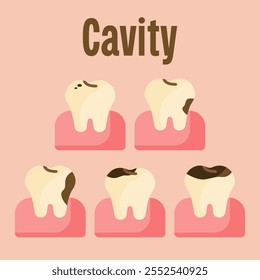 tooth cavity caries carious tooth cavity treatment root canal treatment collection