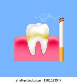 Tooth with cigarette. Smoking effect on human teeth. Dental care concept. Stop smoking, World No Tobacco Day. Illustration on blue background.