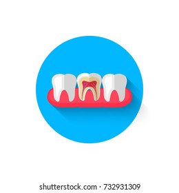 Tooth in the cut icon is isolated in a flat design style vector illustration. Modern icon on the theme of stomatology in stylish colors. Website and design for mobile apps and other projects