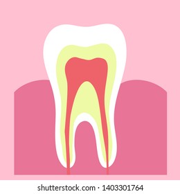 Tooth in a cut on a pink background. Vector illustration.