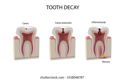 103,687 Teeth anatomy Images, Stock Photos & Vectors | Shutterstock