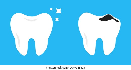 Tooth decay. Bad tooth. Health Care. Stages of caries development, seriousness of destruction. Tooth with caries and healthy tooth. Dental care vector image