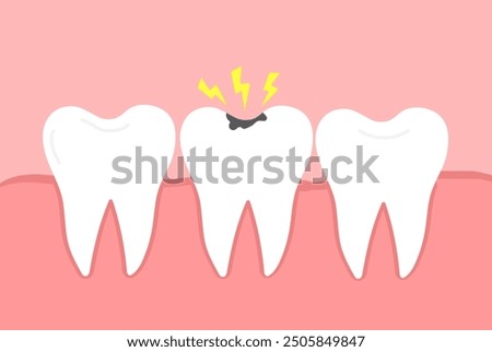 Tooth decay. Dental caries. Toothache molar. Vector illustration