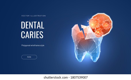 Tooth decay futuristic polygonal vector illustration on blue background. A tooth that is developing tooth decay, enamel decay, or pulp infection. Design for banner or landing page of a dental clinic