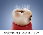 Tooth decay and infection are the causes of bad breath. Realistic vector illustration file.