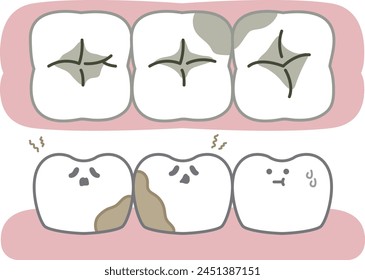 Tooth decay problem- flat illustration 