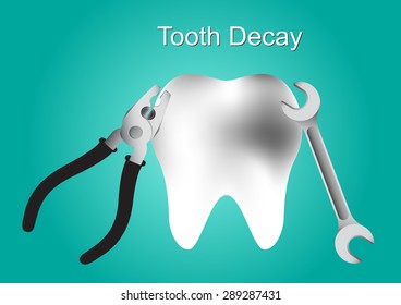 Tooth decay, Tooth decay treatments, tooth vector