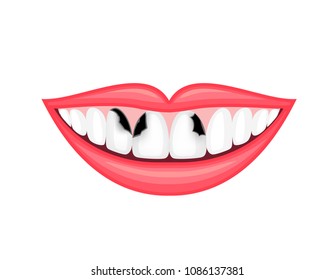 Tooth Decay, Unhealthy Teeth. Human Mouth, Dental Care Concept. Illustration Isolated On White Background.