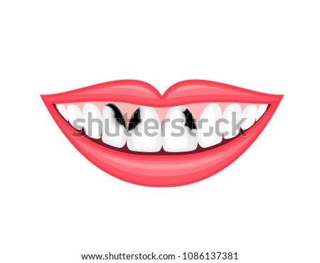 Tooth decay, unhealthy teeth. Human mouth, dental care concept. Illustration isolated on white background.