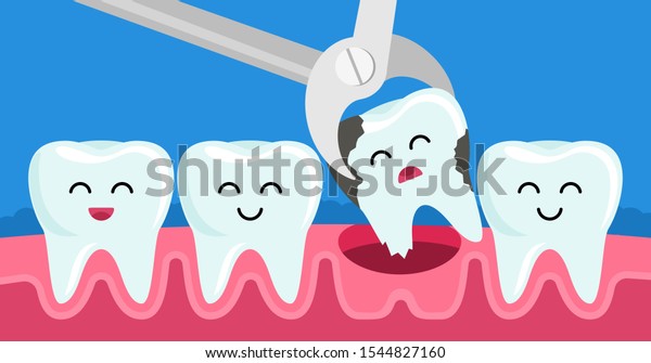 虫歯を抜く歯は 毛抜きで口腔内に取り除く 小児歯科のコンセプト かわいい歯の表情 ベクターイラスト のベクター画像素材 ロイヤリティフリー