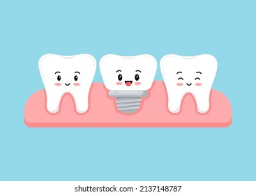 Tooth and dental implant in gum isolated on blue background. Healthy human teeth and implant prosthesis concept. Flat design cartoon style vector orthodontist 
dentistry illustration.