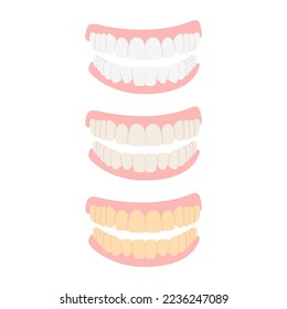 Tooth dental plaque stages icon set. Teeth in different stages of color change development. Flat cartoon vector illustration isolated on background. Dental hygiene, whitening, and treatment concept.