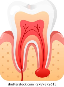 Tooth dental root infection abscess gum anatomy oral cavity pain detailed tooth anatomy showing inflamed root infection with abscess near gum tissue and oral cavity structure for dental education