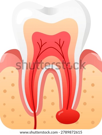 Tooth dental root infection abscess gum anatomy oral cavity pain detailed tooth anatomy showing inflamed root infection with abscess near gum tissue and oral cavity structure for dental education
