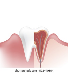 tooth dentistry