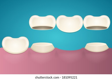 Tooth enamel in section across