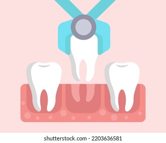 Tooth extraction dental medical concept. oral hygiene flat vector illustration design.