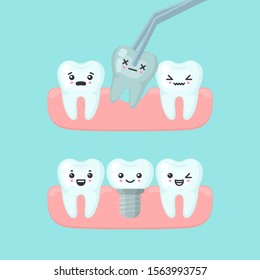 Tooth extraction and implantation stomatology concept. Cute cartoon vector teeth implant isolated illustration