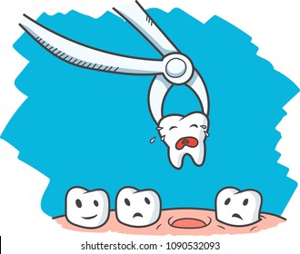 Tooth extraction, removal of tooth