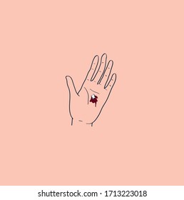 tooth fell out. the molar pulls a palm.