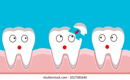 tooth fracture, filling, teeth, trauma, vector illustration.