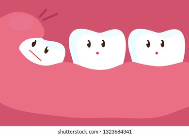 The tooth grows under the gum. Vector illustration.