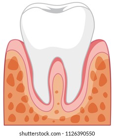 A Tooth in gum  illustration