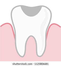 Tooth and gum illustration. Aching tooth. Vector object