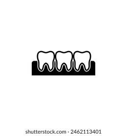 Diente en encía, periodontitis, ícono de Vector plano. Símbolo sólido simple aislado sobre fondo blanco. Diente en encía, Plantilla de diseño de signo de periodontitis para Web y elemento de IU móvil