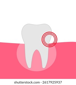 a tooth in the gum , a toothache,