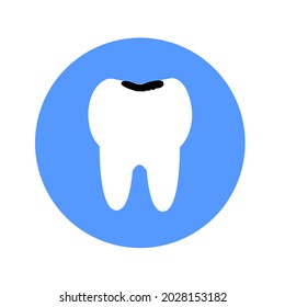 Tooth having cavity and tooth decay. Vector and illustration.