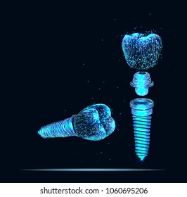 Tooth human implant. Dental concept. Human teeth or dentures. 3d illustration. Low poly vector illustration.