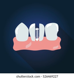 tooth Icon Art