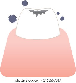 Tooth illustration with cariogenic bacteria