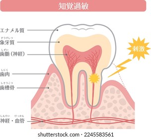 Tooth illustration_Hypersensitivity

In Japanese, it is described as "hypersensitivity", "irritation", "enamel", "dentin", "nerve" and "gingiva".