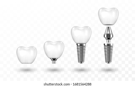 Tooth implant in disassembled form