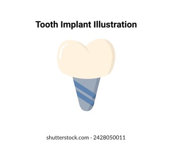 Tooth implant flat illustration. Dentistry and orthodontics vector illustration. Dental clinic services, stomatology, dentistry, orthodontics, oral health care and hygiene vector.