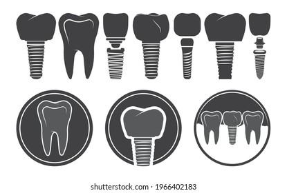 Tooth implant, Implant icon, Dentist, Dental implant icon, Dental implant vector