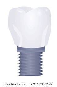 Tooth implant model. vector illustration