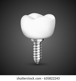 Tooth implant on black background. Vector illustration 