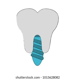 tooth implant symbol