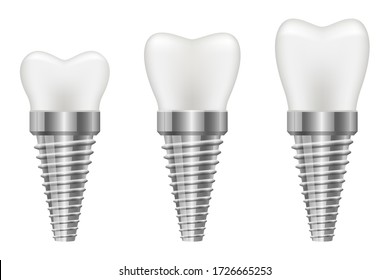 Tooth implant vector design illustration isolated on white background