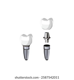 Tooth implant vector design illustration