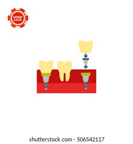Tooth Implant Vector Icon