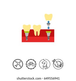 Tooth Implant Vector Icon