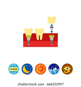 Tooth Implant Vector Icon